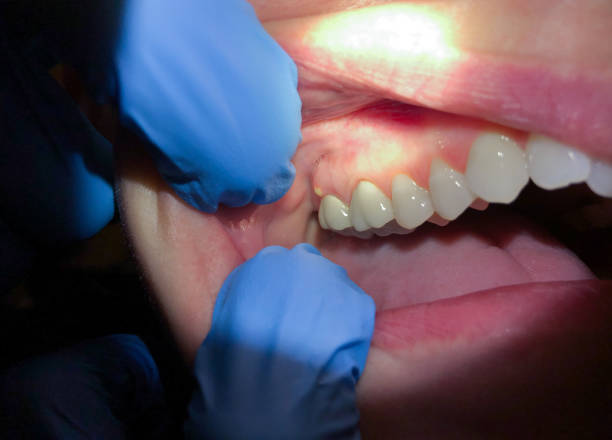  Uhland, TX Emergency Dentist Pros