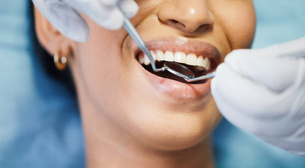 Best Emergency Tooth Extraction in Uhland, TX
