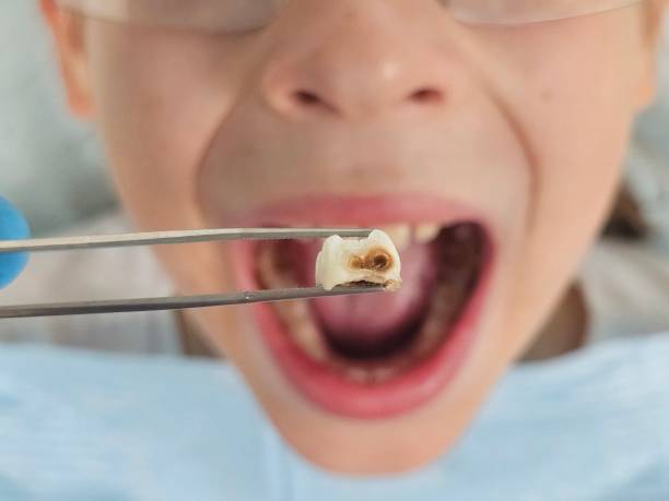 Best Emergency TMJ Treatment in Uhland, TX